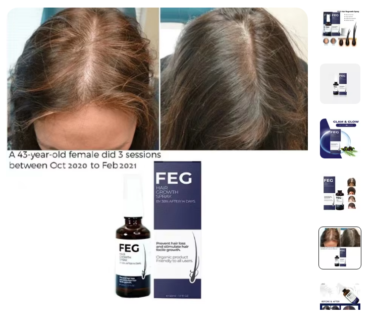 🌿✨ FEG Hair Growth Spray – Stop Hair Fall, Regrow Naturally & Strengthen Roots 💧💪